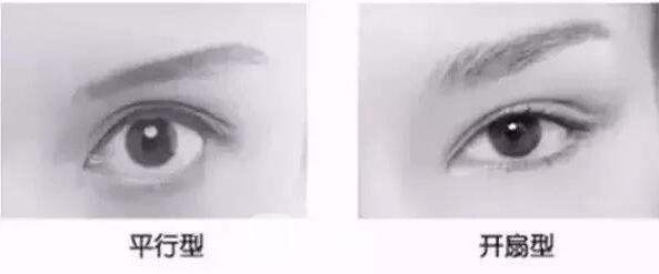 去皮去脂双眼皮失败的原因有哪些