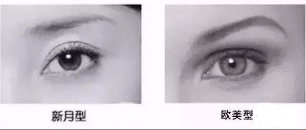 去皮去脂双眼皮失败的原因有哪些