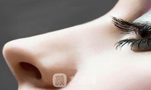 现如今隆鼻的种类有哪些?