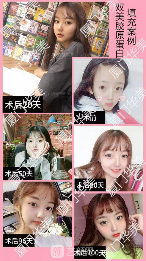 不用工具,10秒自测肌肤年龄的方法在这,戳我!