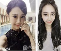眼霜不管用，拿什么拯救你我的泪沟~