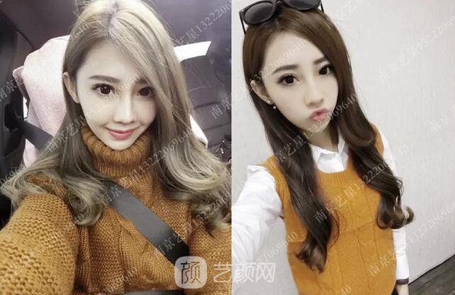 眼霜不管用，拿什么拯救你我的泪沟~