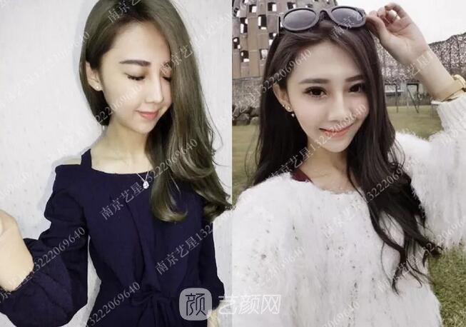 眼霜不管用，拿什么拯救你我的泪沟~