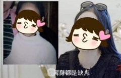 竟因一件衣服决定整容！她的现状如何？