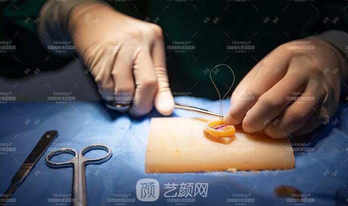 【取肋软骨会影响孩子胸廓发育吗？】