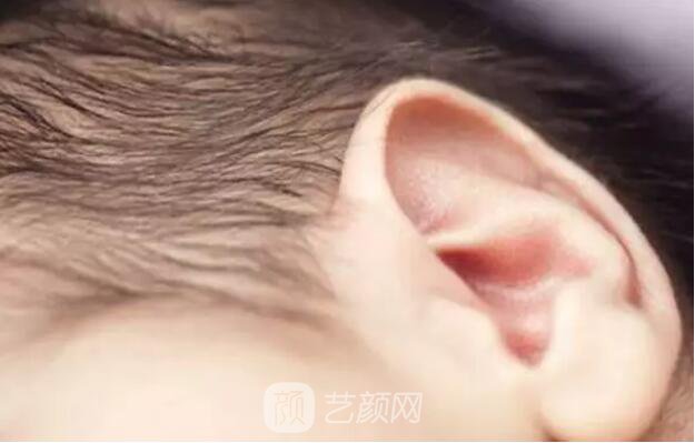 【再造的耳朵软硬度摸起来和正常耳朵一样吗？】