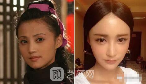 张歆艺虽然整形思路超混乱，但这种女人较怕的纹路她一根都没有…