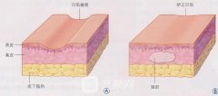 穷得全身只剩脂肪?那就用起来吧