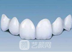 5大因素影响美容冠价格~