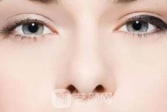 鼻孔缩小手术多少钱?