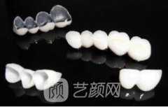 2019春夏北京烤瓷牙价格一览