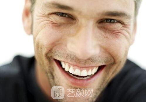 北京整形美容鱼尾纹怎么去?