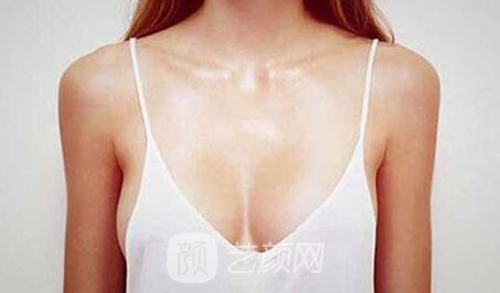 做娜绮丽假体丰胸后反弹吗? 专家分析正确认识哪好