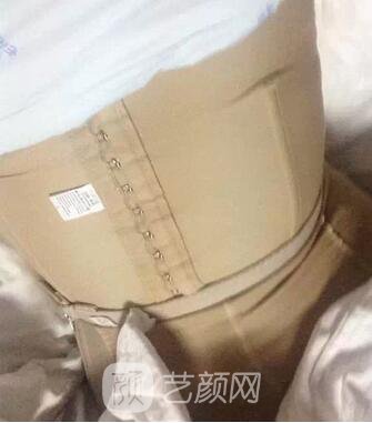 腰部吸脂,终于甩掉了大肚腩