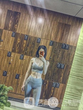 太平公主的变身日记~硅胶假体隆胸