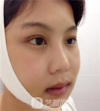 磨腮削骨填额头决心大变身