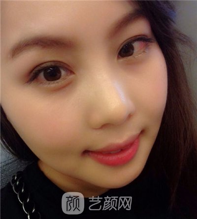 磨腮削骨填额头决心大变身