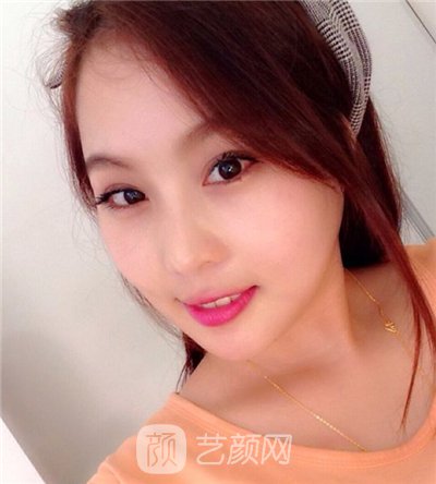 磨腮削骨填额头决心大变身