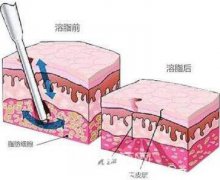 减脂价格大概好多呢？这问题困扰了我很久呢！
