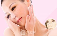 杏林激光嫩肤祛斑要多少钱？