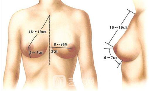 乳晕整形怎样？还你美丽漂亮的乳房