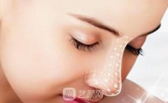 19年成都打玻尿酸隆鼻多少钱?