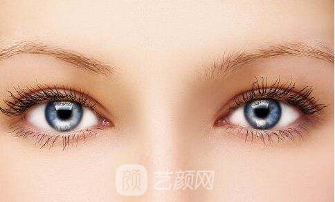 成都恒博做双眼皮手术一般多少钱?