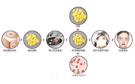 隆鼻+面部脂肪移植后变靓女告别单身