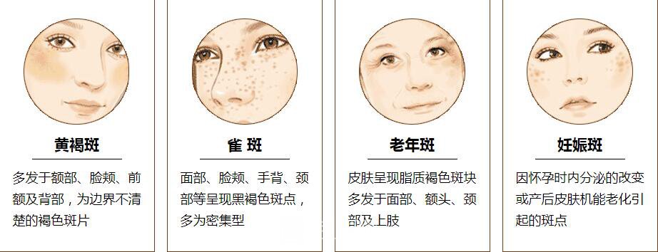 调节黄褐斑是长期的工程，需要坚持才能见果