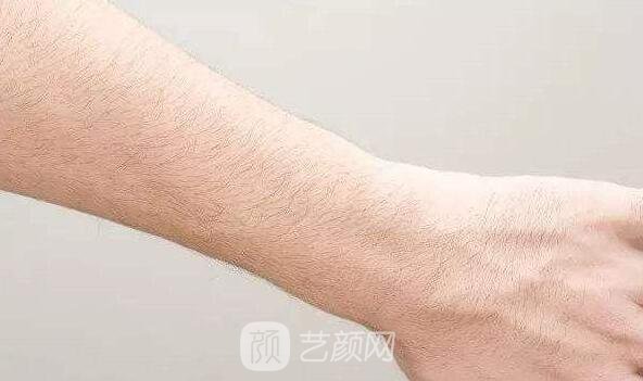 深圳翠绿宝石激光脱毛如何？我们一起来了解一下