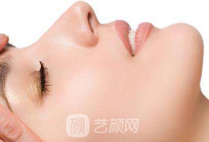 隆鼻案例:隆鼻+双眼皮+下巴已经不是原来自卑的我了~