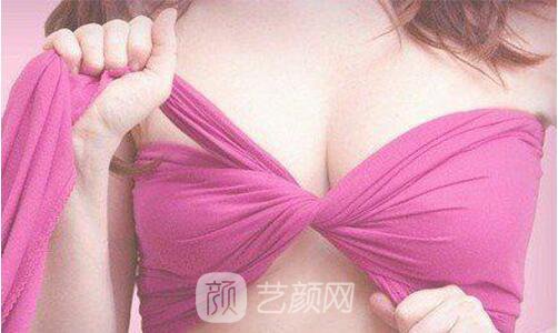 隆胸假体选择哪种果好?我们一一来了解一下