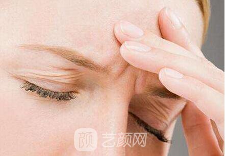 面部去皱术有很多,选适合自己的才是王道