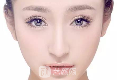 全切双眼皮手术案例,全切双眼皮-秒变女神