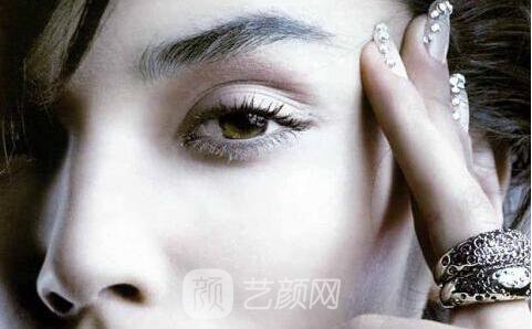 全切双眼皮手术案例,全切双眼皮-秒变女神