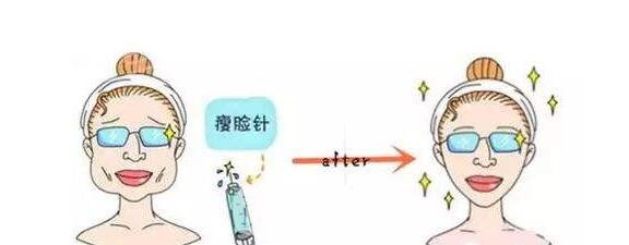 打注射瘦脸后脸真变小了,看来注射瘦脸真如传闻所言