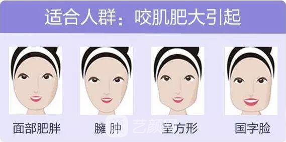 打注射瘦脸后脸真变小了,看来注射瘦脸真如传闻所言