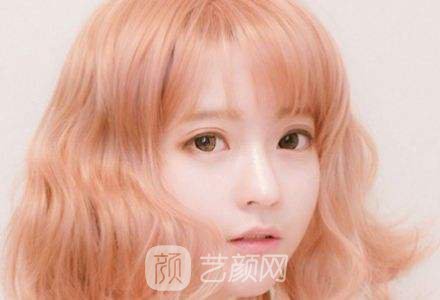 韩式三点翘睫双眼皮恢复过程心里美美哒