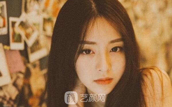 韩式三点翘睫双眼皮恢复过程心里美美哒