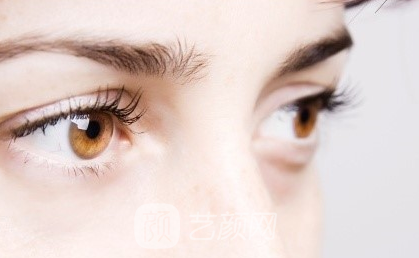 如何让眼睛更美丽的双眼皮手术？
