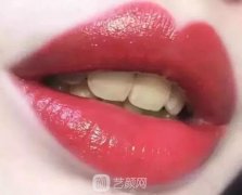 趁热美牙|你的口红再贵，我只看到一口黄牙！