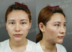 你的看法对我很重要，所以你说她变美了吗？