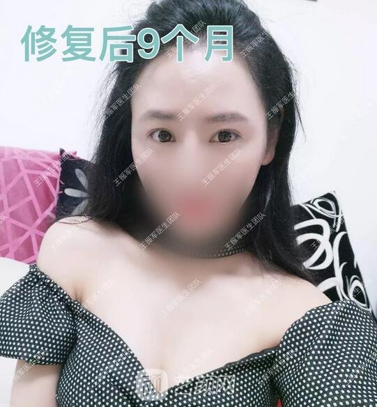 术后9个月果图