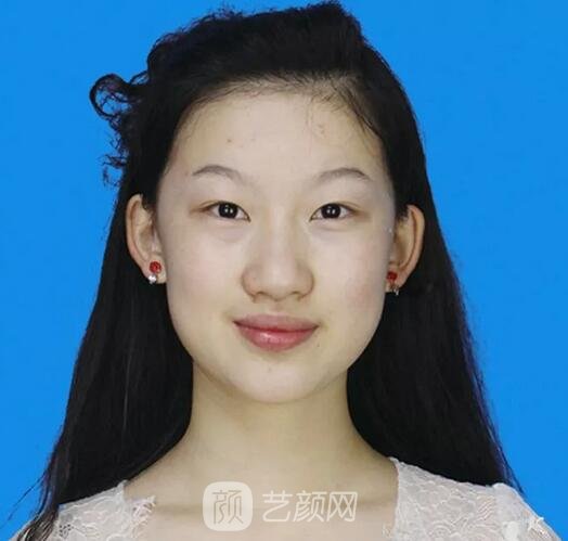 鄭裕錫歐巴駕到：扇形&平行如何選？