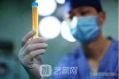 俞富兴医生做脂肪填充技术怎么样？好的医生真的很重要！