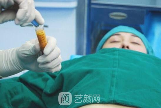 廉红伟在水动力吸脂方面有着娴熟的手法，他的方法对身体伤害极小