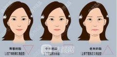 30 40 50岁各阶段出现面部皮肤松弛下垂后适合的手术方法及价格~