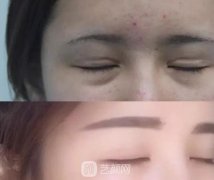 30年前割双眼皮的女孩 现在都怎么样了呢？