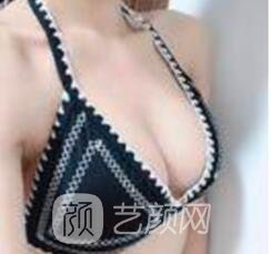 价钱要看胸部的不成功状况