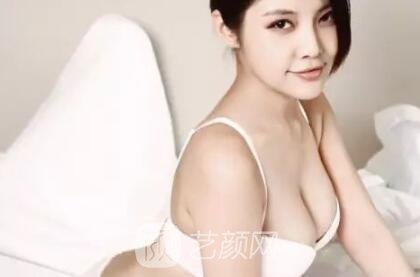 假体隆胸失败修复时间：到底术后多久才能做修复？